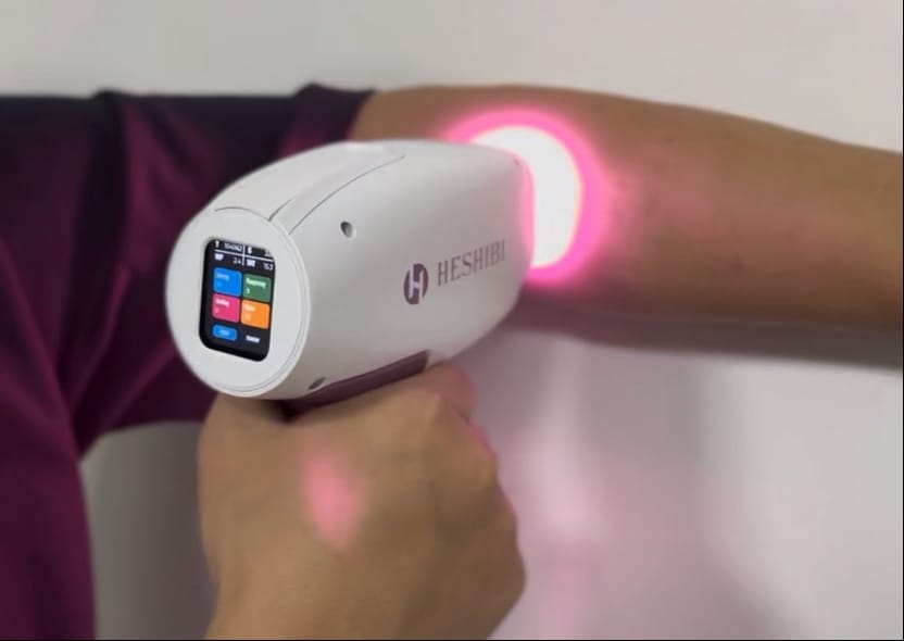 Is Your Hair Removal Solution Future-Proof? Exploring the Benefits of ODM Diode Laser Hair Removal